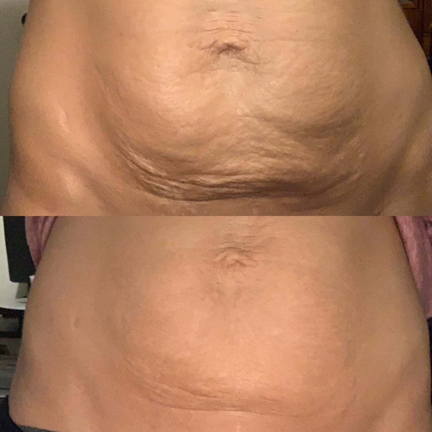 Celessa Anti-Cellulite Massage Oil