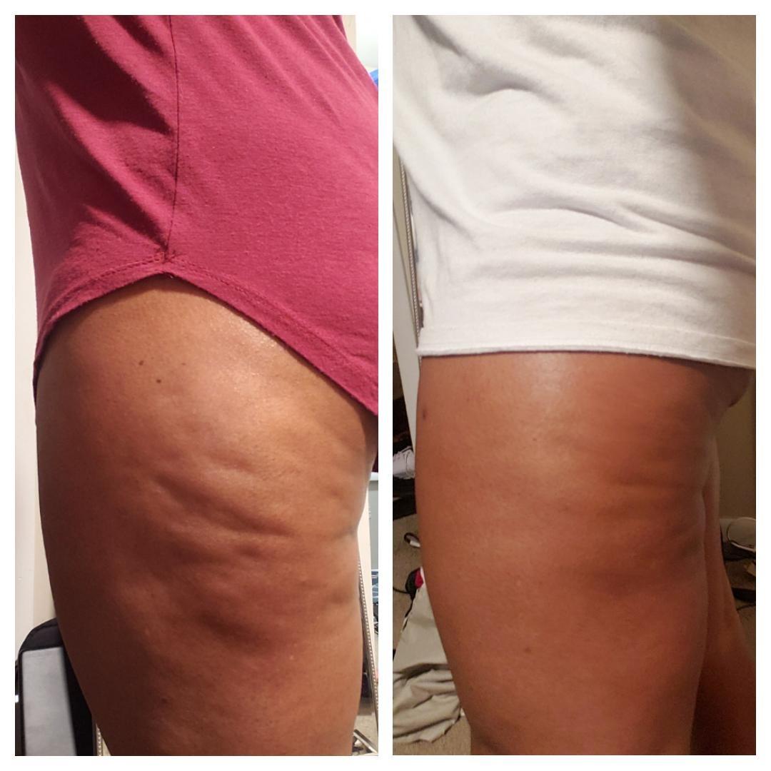 Celessa Anti-Cellulite Massage Oil